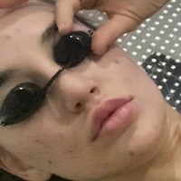 blakeblossomfree Nahé