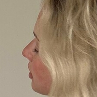 blondesnooki3 Nahé