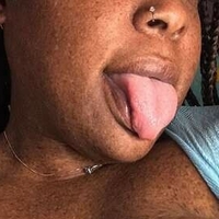 freckledfantasy5 Nahé
