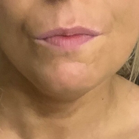 Holytits Nahé