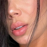 lopezeli Nahé