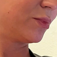 misslobatox Nahé