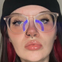 sexymigraines Nahé