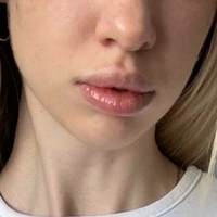 shellysecret Nahé